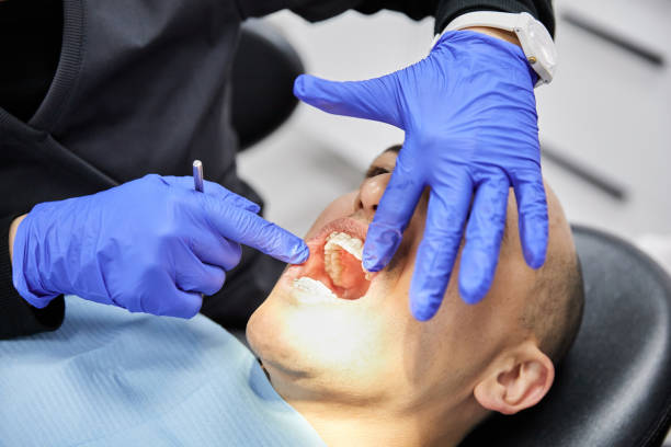 Best Broken or Chipped Tooth Repair in Seabrook Farms, NJ